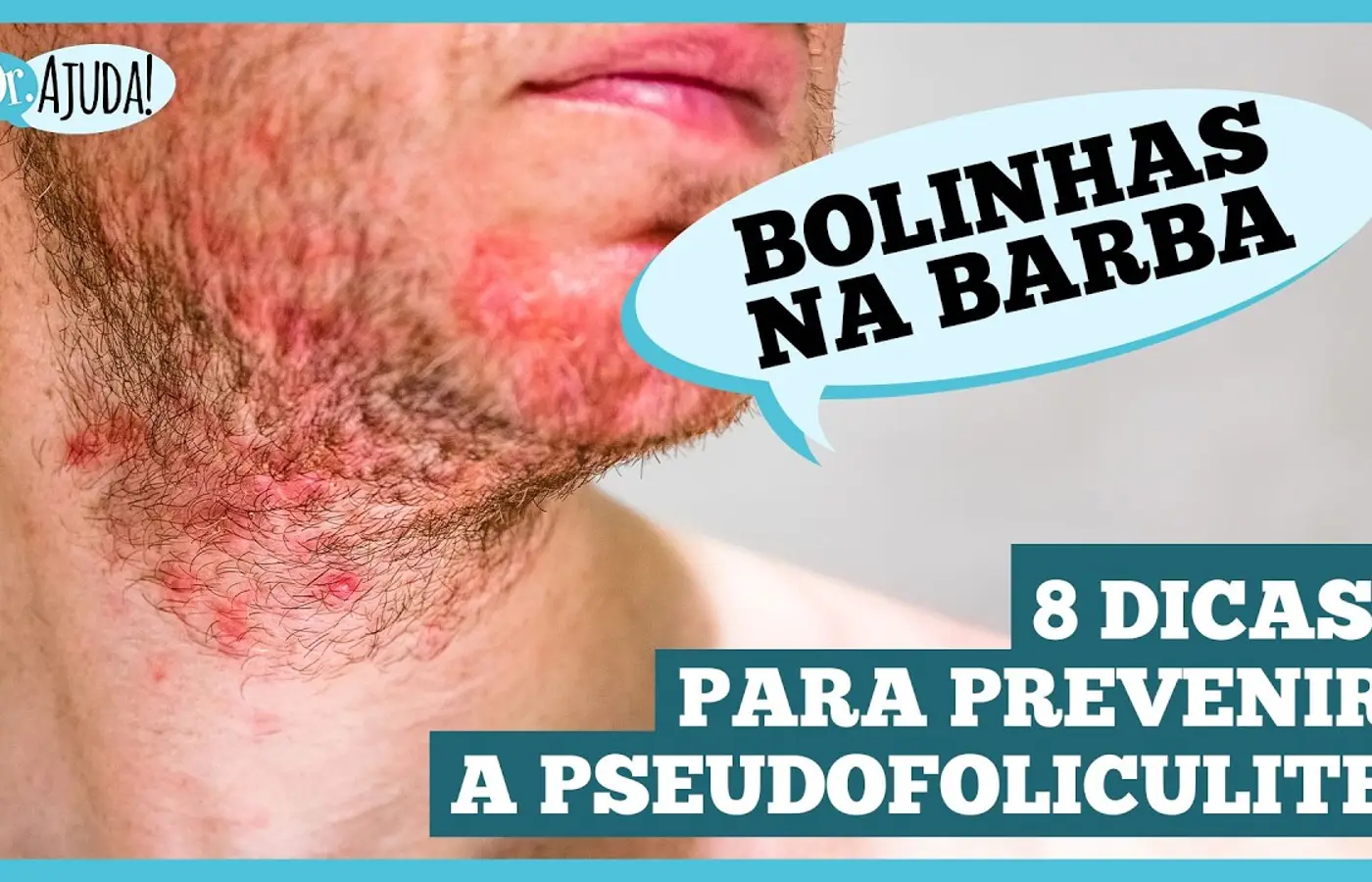 pseudofoliculite:-saiba-como-prevenir